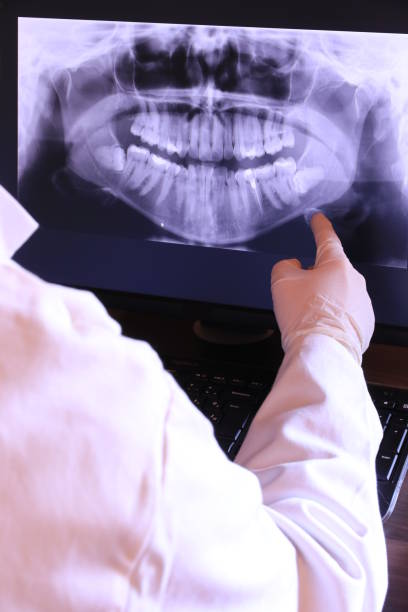 Best Emergency Tooth Extraction in Fkville, AL