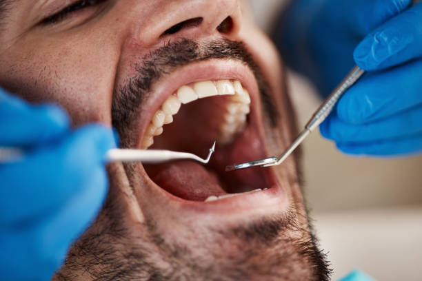 Best Emergency Treatment for Toothache in Fkville, AL