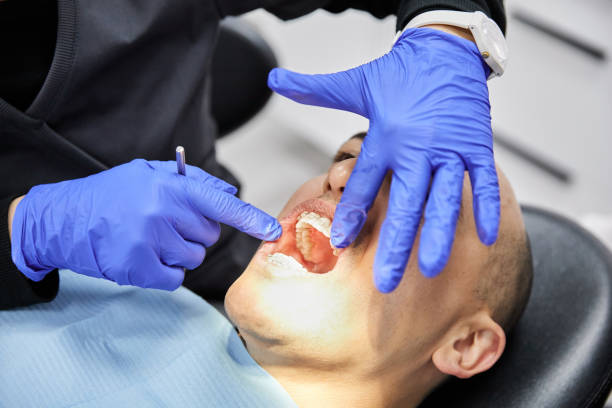 Best Emergency Dental Surgery in Fkville, AL