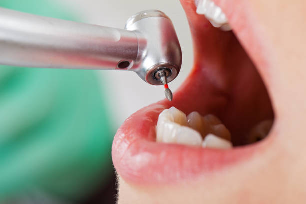 Best Emergency Orthodontic Repairs in Fkville, AL